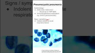 Pneumocystis pneumonia [upl. by Ohploda]