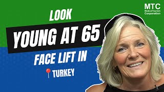 Kates Transformation at 65 Review of Facelift in Istanbul Turkey [upl. by Urquhart]