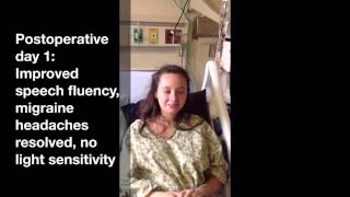 Right Perilymph Fistula Dizziness Migraine Headaches and Cognitive Dysfunction [upl. by Allissa]