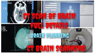 How to do CT scan of brain in GE machine  CT Brain Planning CT scan Brain in details Prasad Layek [upl. by Phira]