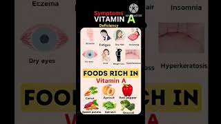 Vitamin A deficiency vitamin A rich foodsvitamin A symptoms vitamins [upl. by Sauer]