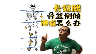 134骨盆侧倾一高一低长短腿腰痛怎么运动 [upl. by Acir]