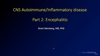 Imaging CNS autoimmune and inflammatory disease  2  Encephalitis [upl. by Korfonta625]