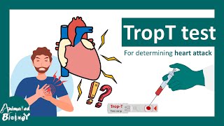 TropT test  What if Trop T test is positive  Troponin T blood test [upl. by Nagn]