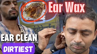 Dirtiest Ear Wax found During Ear Cleaning at Street Side Ear Cleaner  ASMR [upl. by Ralat]