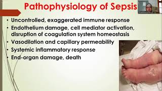 Pathophysiology of Sepsis amp SIRS  3rd Year  Infectious Diseases Module  Pathology [upl. by Zetra]