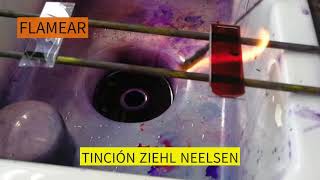 TINCION ZIEHL NEELSEN [upl. by Aierdna1]