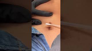 Belly Piercing Rehab with our Piercing Bump Treatment Flawless piercings with Base Laboratories 🥳 [upl. by Nerwal]