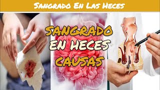 ⚕️🩺 SANGRE EN LAS HECES Causas y Tratamiento [upl. by Moreta]