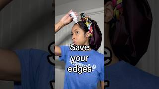 How to Remove Lace Glue wo Damaging Your Edges lacefrontwig edges beautyhacks shorts [upl. by Violante]