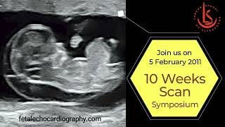 10 Weeks Scan Symposium 2022 [upl. by Sitof]