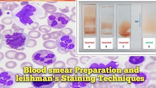 Blood smear Preparation l Leishmans Staining Techniques l Leishmans Staining Procedure ln Odia l [upl. by Burty493]