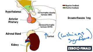 Understanding The Dexamethasone Suppression Test [upl. by Pelagias144]