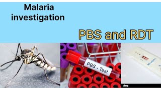 Malaria patients investigations  peripheral blood smear test  RDT test [upl. by Yentruok]