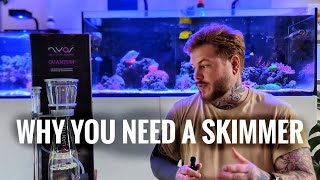 Why You Need A Skimmer In Your Aquarium│Nyos Quantum 120 [upl. by Haase]