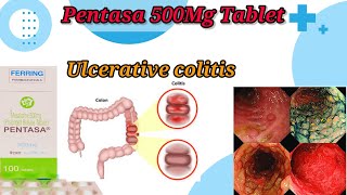 Pentasa 500Mg Tablet UseBenefitsSide EffectsUlcerative Colitis TreatmentFull Reviews [upl. by Margarette]