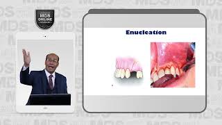 9 2 Enucleation [upl. by Silloh340]