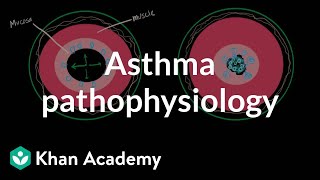 Asthma pathophysiology  Respiratory system diseases  NCLEXRN  Khan Academy [upl. by Enilrek917]