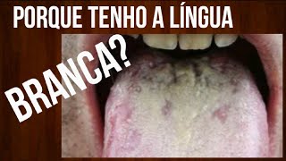 LÍNGUA BRANCA  O que é  como tratar  SABURRA LINGUAL [upl. by Morra678]