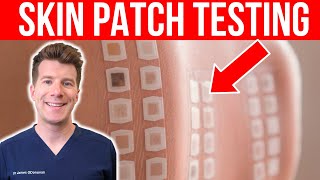 ALLERGY TESTING Doctor explains the Skin Patch Test [upl. by Rehprotsirhc336]