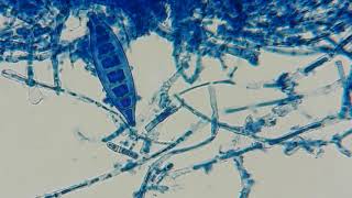 31 Macroconidia Microsporum canis [upl. by Davine]