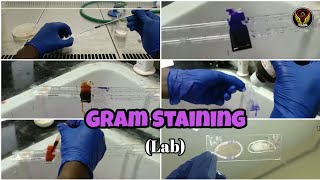 Gram Staining  Demo  Smear Preparation  Microbiology Lab  Tamil  Biology  ThiNK VISION  TNK [upl. by Letizia]