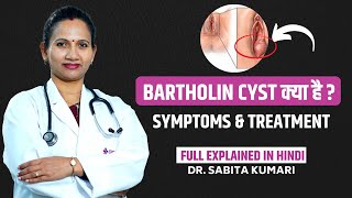 What Is Bartholin Cyst   बार्थोलिन सिस्ट क्या है और इसका इलाज कैसे होगा [upl. by Seymour]