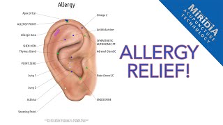 Auriculotherapy for Allergy Relief DIY Allergy Protocol [upl. by Reace]