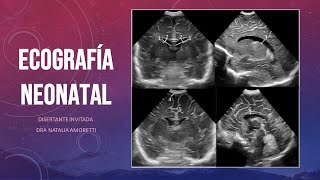 Clase de ecografía neonatal [upl. by Bendicty]