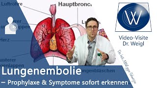 Lungenembolie ⚠ unbedingt vorbeugen amp schnell erkennen  Symptome Behandlung amp Ursachen erklärt ✅ [upl. by Anined800]