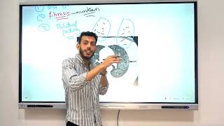 Lecture 5 Restrictive Lung disease tumors of lung diseases of pleura [upl. by Pooi643]