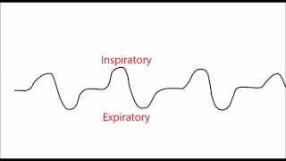 CPAP and BiLevel What is EPR Aflex and Cflex [upl. by Ydnyc]