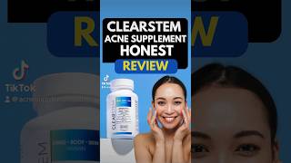 Clearstem Acne Supplement Honest Review acneproneskin skincareroutine [upl. by Oremo591]