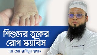 Scabies  Scabies Treatment  Scabies Symptoms  খোস পাঁচড়া ও তার প্রতিকার [upl. by Lenes]