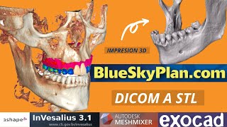 CÓMO CONVERTIR DICOM A STL😮 IMPRESION 3D BLUESKYPLANODONTOLOGIA DIGITAL [upl. by Inol]