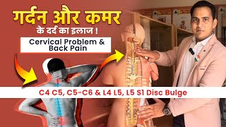 FullVideo👉C4 C5 C5C6 amp L4 L5 L5 S1 Disc Bulge  गर्दन और कमर के दर्द का इलाज Cervical amp Back Pain [upl. by Hairahcez]