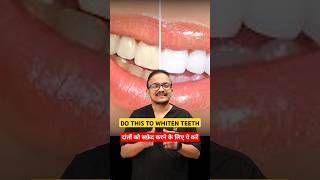 2 ways of teeth whitening suratdentist dentist smiledentist [upl. by Ashlee]