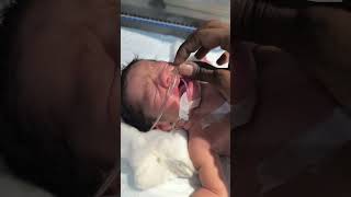 The newborn baby is so nice sumitnicunursingstm youtubeshorts nursing newbornbaby cutebaby [upl. by Tiraj]