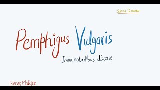 Pemphigus Vulgaris  clinical features pathophysiology and histology  immunobullous skin disease [upl. by Anovahs]