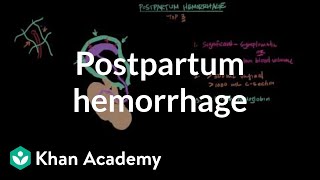 Postpartum hemorrhage  Reproductive system physiology  NCLEXRN  Khan Academy [upl. by Ennaed]