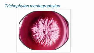 Superficial Fungal Infections Dermatophytes Part 2 Hot Topic [upl. by Kieger]