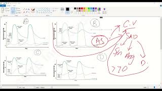 Heart murmursAortic regurgitation amp stenosisMitral Stenosis amp regurgitationUSMLE step 1 [upl. by Hertz316]