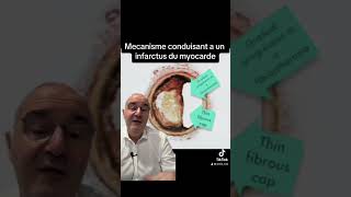 Mécanisme conduisant a un infarctus du myocarde [upl. by Nelan]