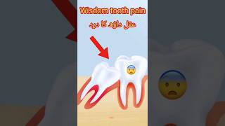 wisdom tooth  aqal darh ka dard  shorts viral dentalasmr wisdomtooth [upl. by Yenobe298]