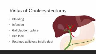 What is Laparoscopic Cholecystectomy [upl. by Cirderf739]