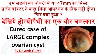 Complex Ovarian Cyst cured case Large Hemorrhagic Cyst complication of complex ovarian cyst [upl. by Miriam]