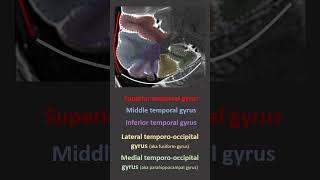 Temporal Lobe Anatomy on imaging [upl. by Lucania]