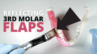 How To Reflect And Retract A FullThickness Flap For Third Molar Surgery  OnlineExodontiacom [upl. by Ferrell]