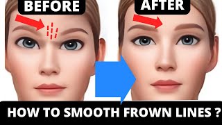 HOW TO GET RID OF WRINKLES  HOW TO GET RID OF FROWN LINES [upl. by Elladine]