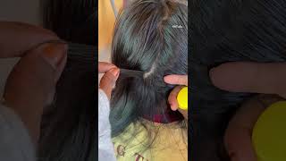 Satisfying hair nitsremoval headliceremoval liceremoval licetreatme headlicetreatment [upl. by Brey]